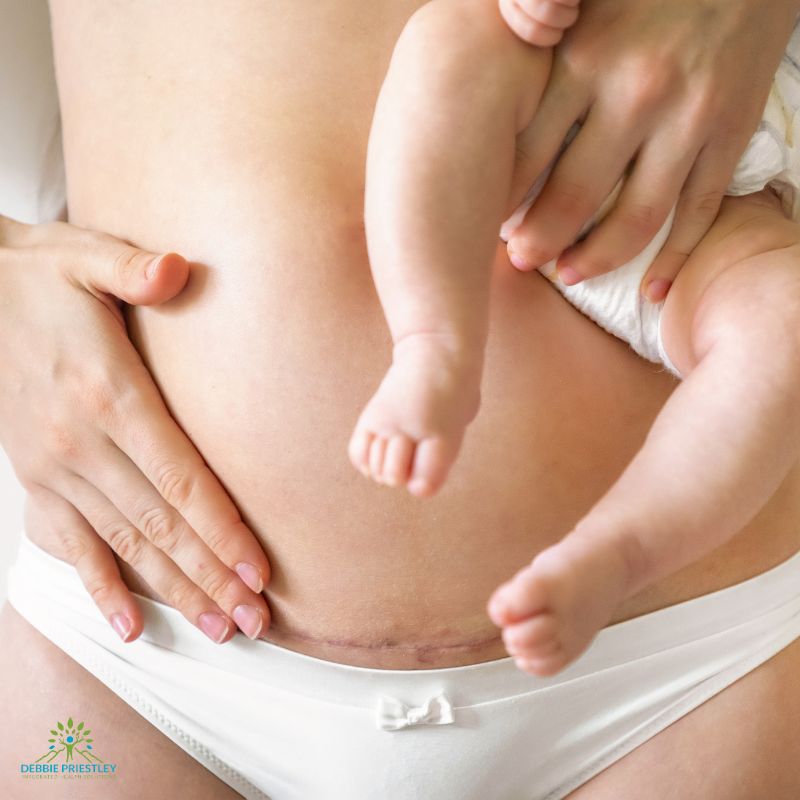 Scar Tissue Therapy-2