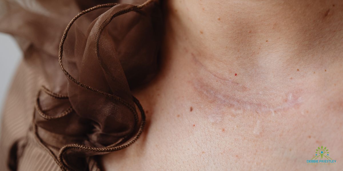 Scar Tissue Therapy in York-2